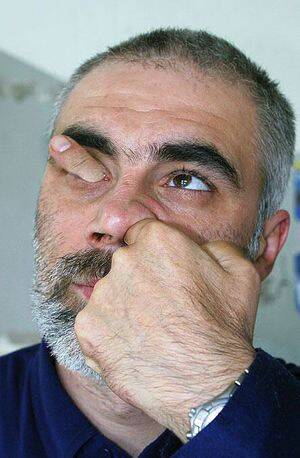 Homme la main sur le visage